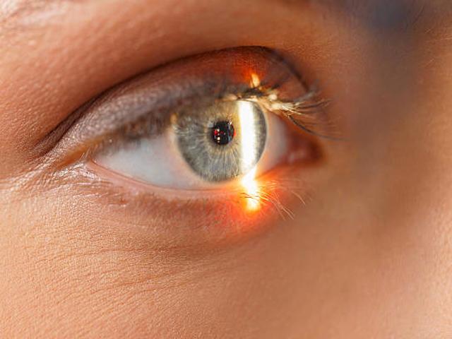 Phẫu thuật mắt bằng laser, người phụ nữ bị đốt cháy luôn võng mạc