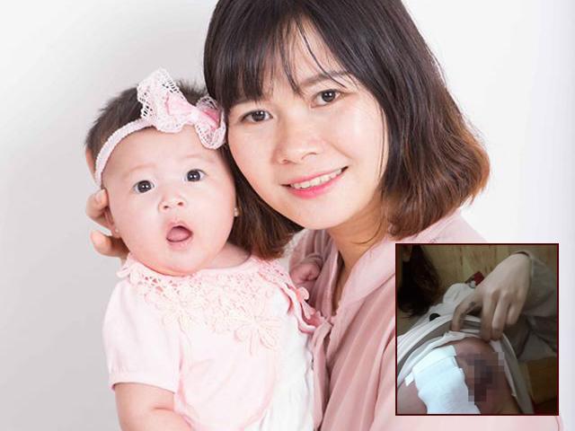 Bà mẹ đau gấp trăm lần đi đẻ, ngực tan nát vì chữa áp xe bằng mẹo dân gian