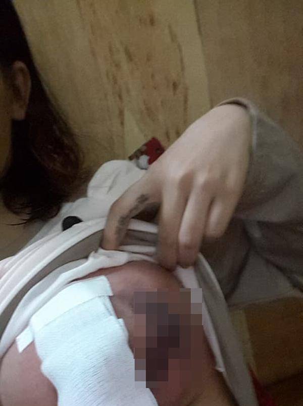 Thông tắc tia sữa tại nhà quận Phú Nhuận Thông tắc tia sữa tại nhà quận Phú Nhuận