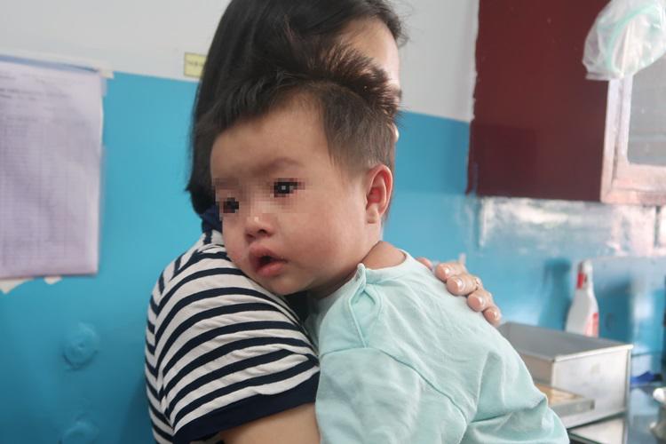 nhieu tre em, thai phu nhap vien vi soi tai tphcm: da co truong hop thai luu vi benh - 1