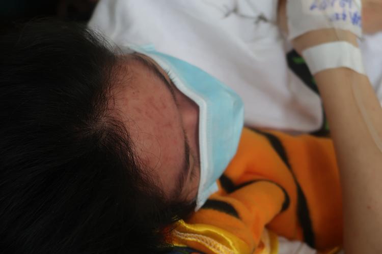 nhieu tre em, thai phu nhap vien vi soi tai tphcm: da co truong hop thai luu vi benh - 3