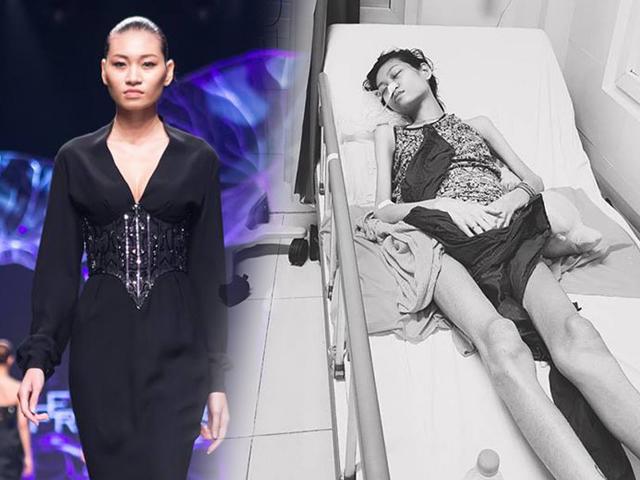 Người mẫu Kim Anh qua đời vì ung thư buồng trứng, phụ nữ có đặc điểm này dễ mắc bệnh