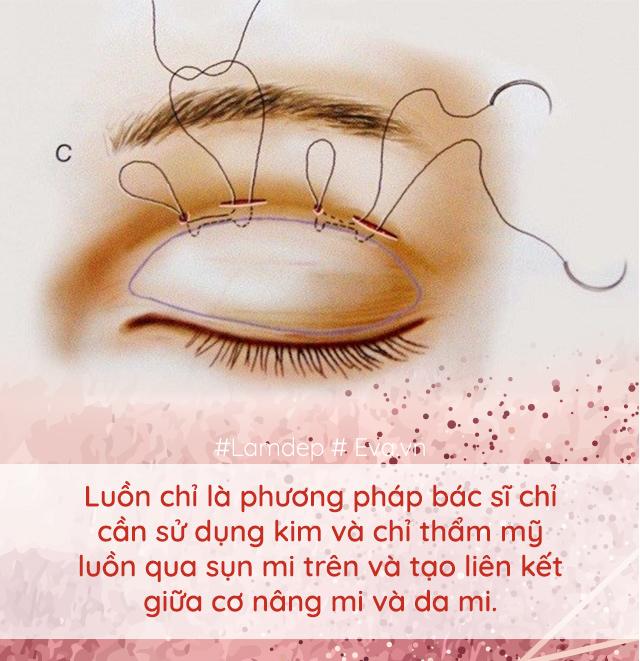 Làm đẹp thế nào khi cứ mãi lẫn lộn nhấn mí với cắt mí, đây là điều bạn cần biết!