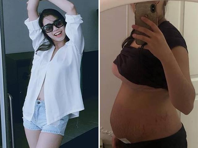 Mẹ trẻ đăng một bức ảnh, chị em bỉm sữa thốt lên: Bầu bí tàn phá cơ thể ghê quá!