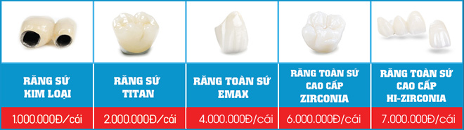 Lý giải vì sao trồng răng sứ 1 răng phải làm thành 3 răng