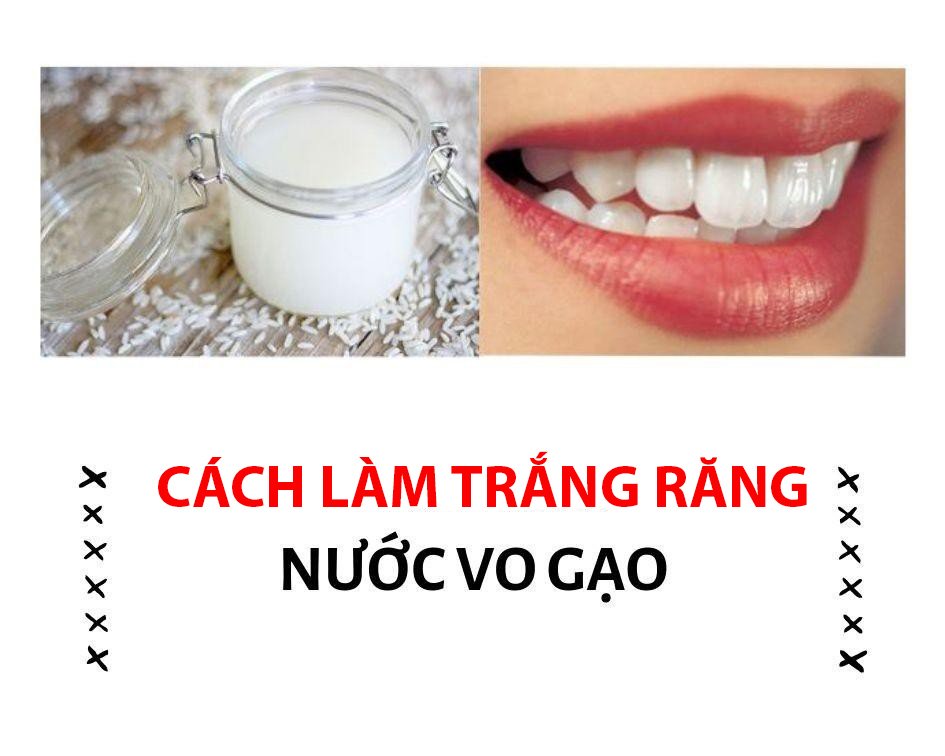 15 Cách làm trắng răng tại nhà nhanh nhất từ nguyên liệu dễ kiếm rẻ tiền - 4