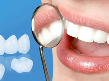 Bọc răng sứ thẩm mỹ để có hàm răng trắng và nụ cười hoàn hảo, nên hay không?