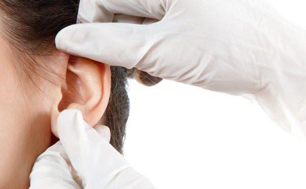 Viêm tai giữa ở trẻ em: Nguyên nhân, dấu hiệu và cách điều trị bệnh - 4