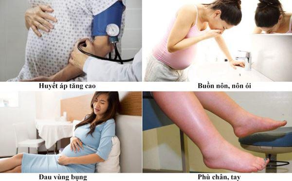 Dấu hiệu tiền sản giật mẹ bầu cần biết để tránh nguy hiểm cho mẹ và bé - 1