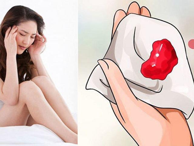 Sự thật kinh nguyệt ra cục máu đông nhìn như bào thai - 1