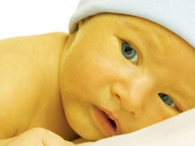 Trẻ sơ sinh bị vàng da vàng mắt như thế nào là nguy hiểm? - 3