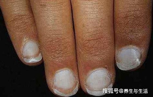 noi khong voi bia ruou nhung lai mac ung thu gan, 2 thoi quen nay chinh la thu pham - 6