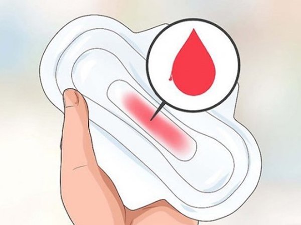 Ra máu khi mang thai tháng đầu là bị làm sao, có phải sảy thai không? - 1