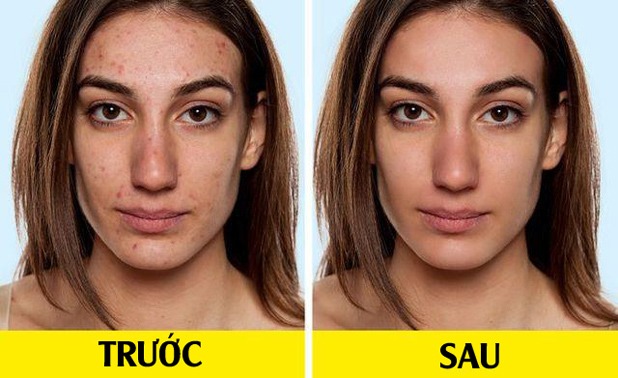 Ngừng uống sữa có lợi hay hại? 5 sự thay đổi này sẽ cho bạn biết kết quả chính xác - 5