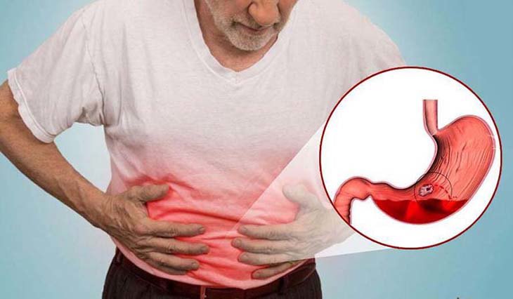 Đau dạ dày có nên ăn sữa chua không? - 1