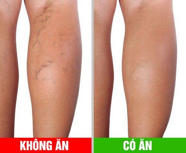 Ăn ớt chuông mỗi ngày thu về 8 lợi ích, nhưng ăn sống hay ăn chín tốt hơn? - 5