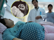 Đang siêu âm thai, bác sĩ cười lớn khi phát hiện ra   khuôn mặt bí ẩn   cạnh em bé
