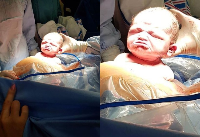The newborn baby has a harsh face like the whole world, a lovely appearance 2 years later - 1