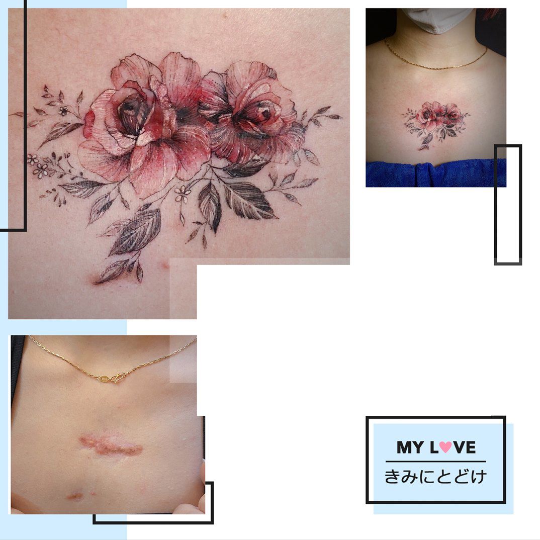 Tattoo Hai Phong  Xăm hình che vết bớt cho cô gái xinh đẹp  Hai Anh Tattoo   YouTube