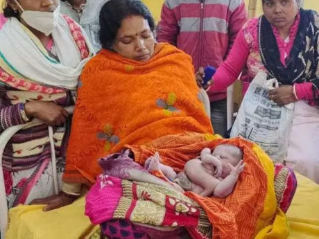 Em bé Ấn Độ chào đời có 4 chân, 4 tay, dân chúng bỗng ào ào đến thờ cúng