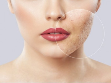Những thói quen làm cạn kiệt collagen trong cơ thể, không sửa ngay thì chưa đến 30 tuổi da đã nhăn