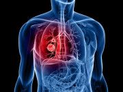 Clip Eva - 3 thay đổi trên cơ thể cảnh báo nguy cơ ung thư phổi