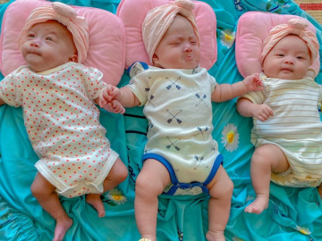 5 năm hiếm muộn phải nhờ cậy IVF, mẹ bầu chuyển 2 phôi được hẳn 3 thiên thần