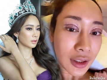 Hoa hậu Thái Lan đập mặt xây lại phải trả giá đắt, nhìn ảnh hậu thẩm mỹ chị em muốn dao kéo vội quay xe