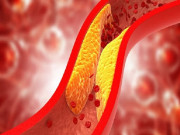Sức khỏe - 12 loại thực phẩm tốt cho người bị cholesterol cao không nên bỏ qua
