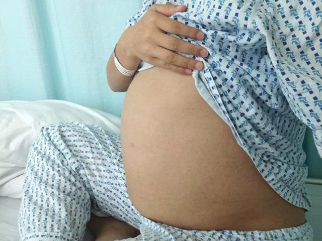 Nữ sinh khiến bác sĩ á khẩu khi mang thai cũng không biết, đến ngày đẻ tưởng đau bụng kinh