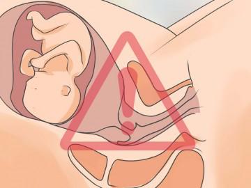Rỉ ối bao lâu thì sinh?