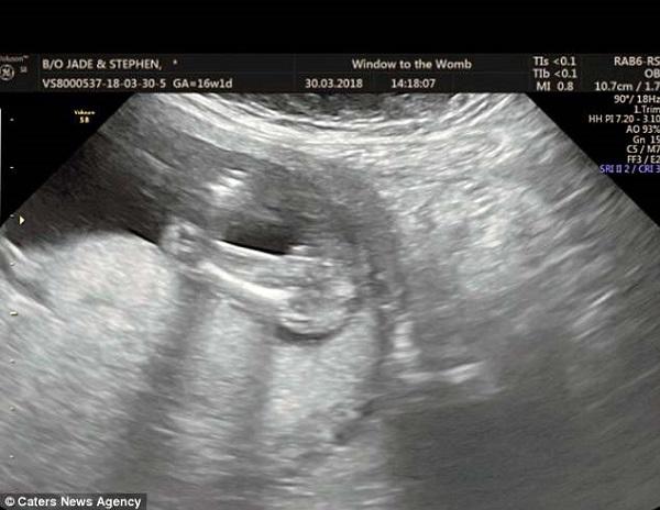 Hình ảnh siêu âm thai: Những hình ảnh siêu âm của con yêu trong bụng mẹ là một cái nhìn cạnh tranh và chân thật hơn so với các ảnh chụp điện thoại thông thường. Từ hình dáng đầu cho đến các vị trí khác trên cơ thể của chúng, bạn có thể cảm nhận được con yêu của mình như thật.