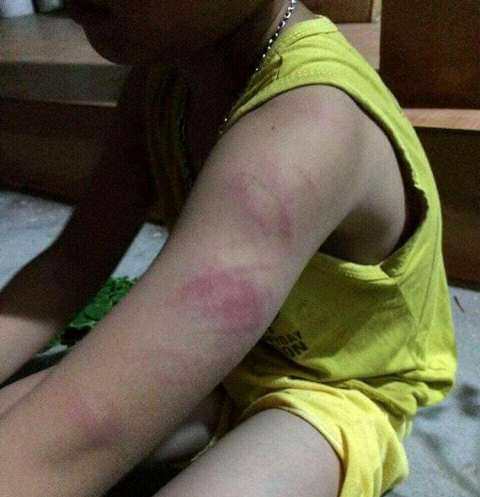 be trai lop 1 khong doc thong, viet thao bi co giao danh bam canh tay - 2