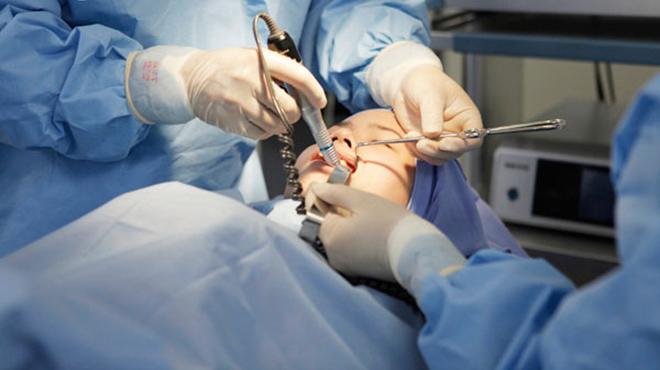 truot cam von phuc tap va co rui ro bien chung cao, vay chi em can luu y dieu gi? - 4