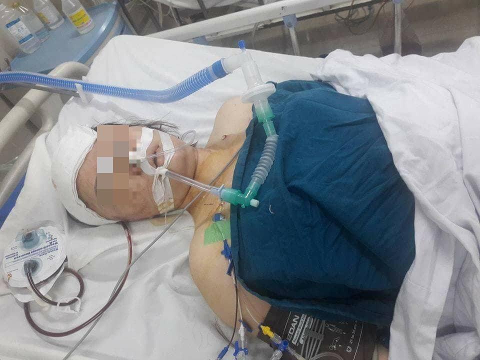 ha noi: he lo manh moi ke gay tai nan khien thai phu chan thuong so nao - 1