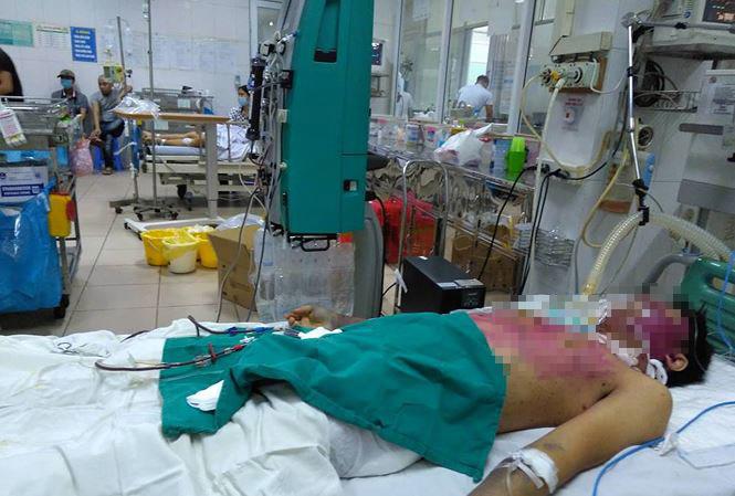 tu y mua thuoc dieu tri thuy dau tai nha, 2 nguoi chet, 1 nguoi nguy kich - 1