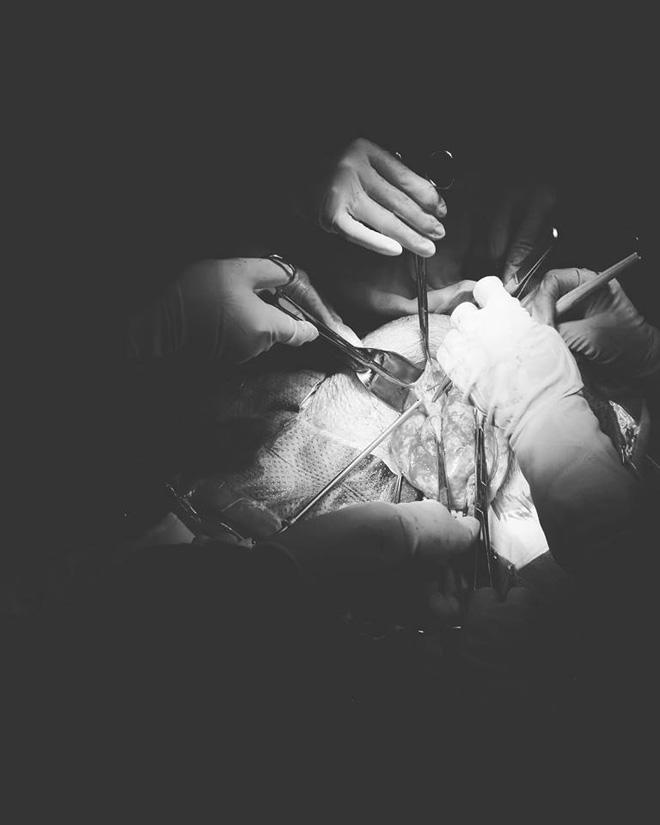 nguoi phu nu duoc giai thoat khoi khoi u “khung” nhat viet nam sau 4 nam mang trong bung - 2