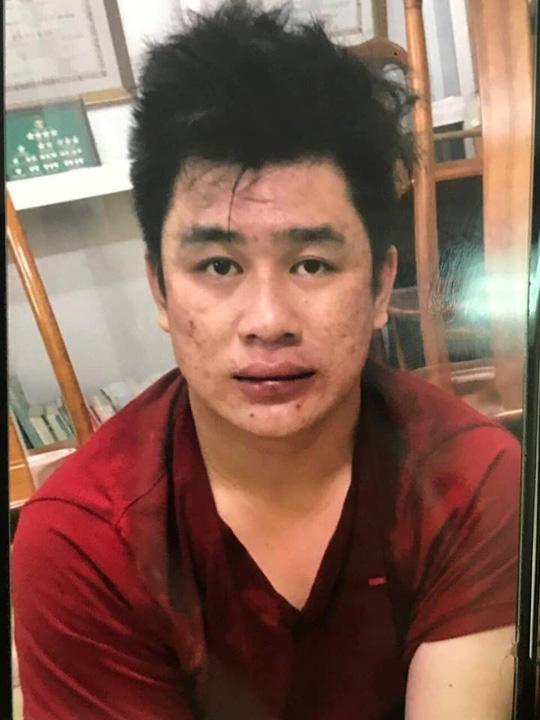 tin tuc 24h: bat doi tuong thu 3 trong vu hai "hiep si" sai gon bi dam chet - 1