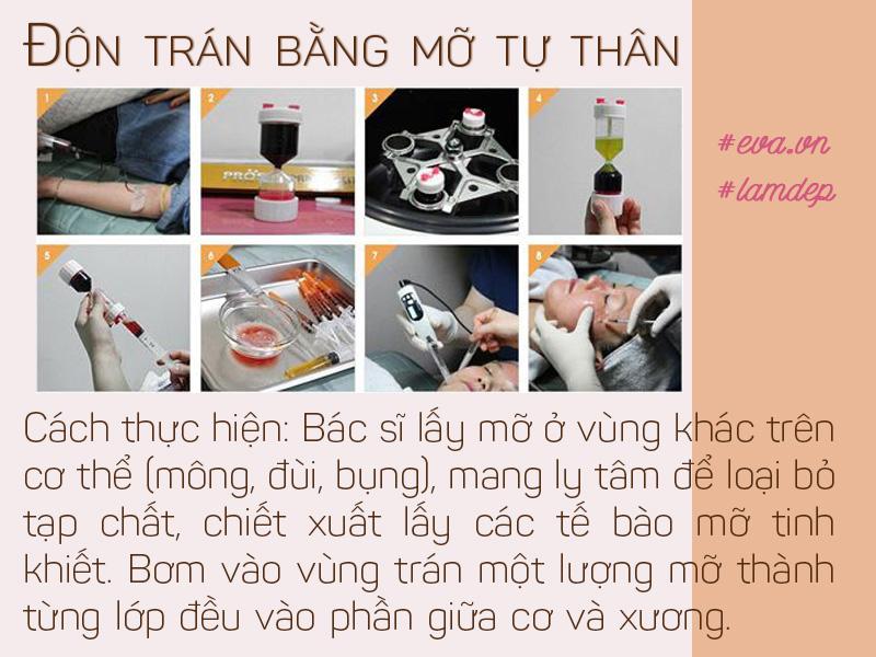 [Image: vua-cai-thien-hinh-dang-tran-vua-tao-dan...ght600.jpg]