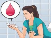 Mang thai ra máu nhưng không đau bụng, có cần lo lắng?