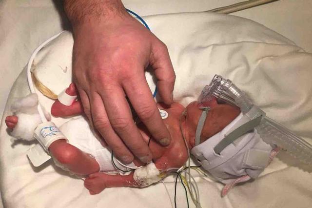 mang thai 30 tuan khong thay bung to len va con dap, me di sieu am phat hien tin soc - 3