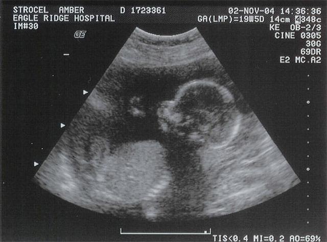 mang thai 30 tuan khong thay bung to len va con dap, me di sieu am phat hien tin soc - 2