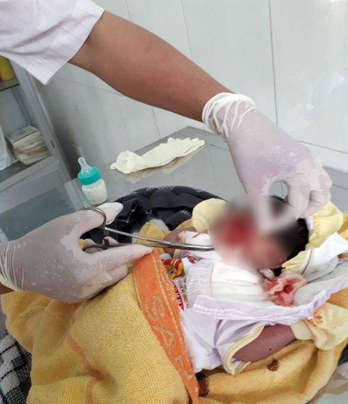 tin tuc 24h: hoang hon phat hien be so sinh nghi bi chon song, con nguyen day ron - 1