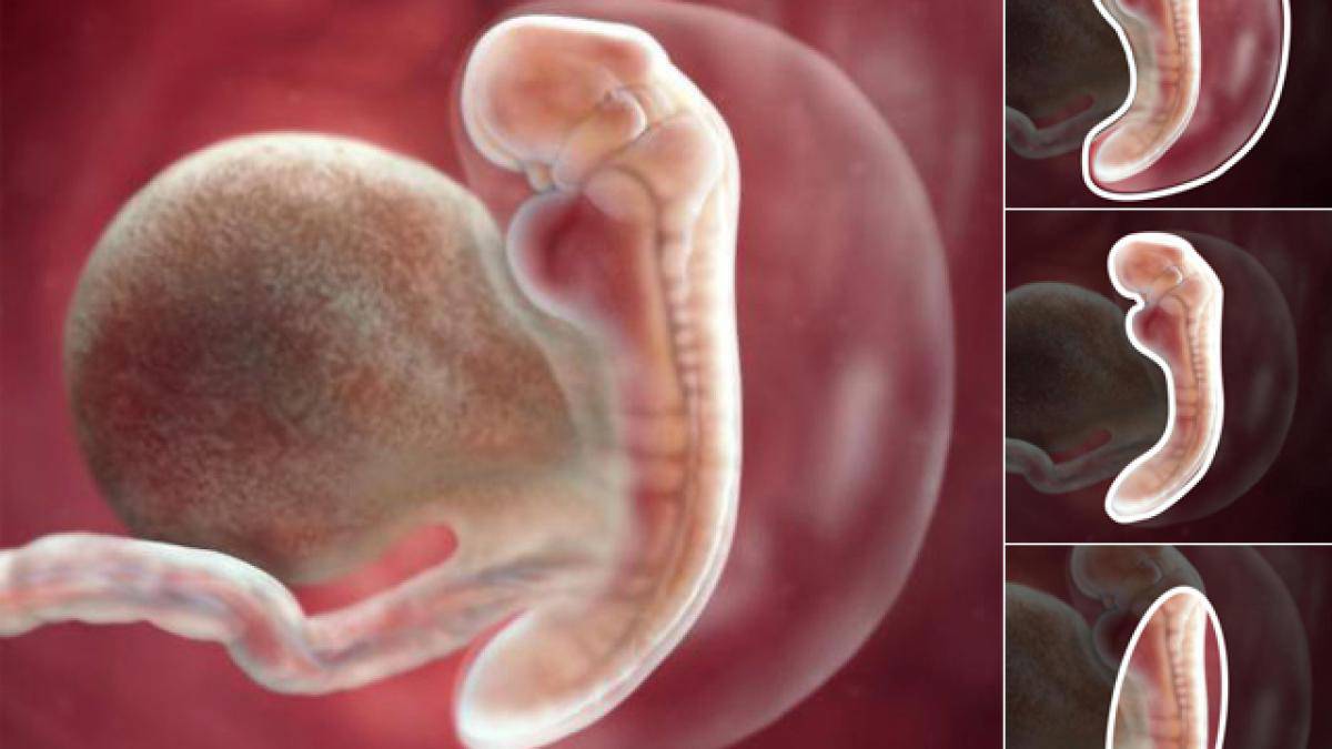 Thai nhi 5 tuần tuổi: Bé trông giống một con nòng nọc hơn là một em bé