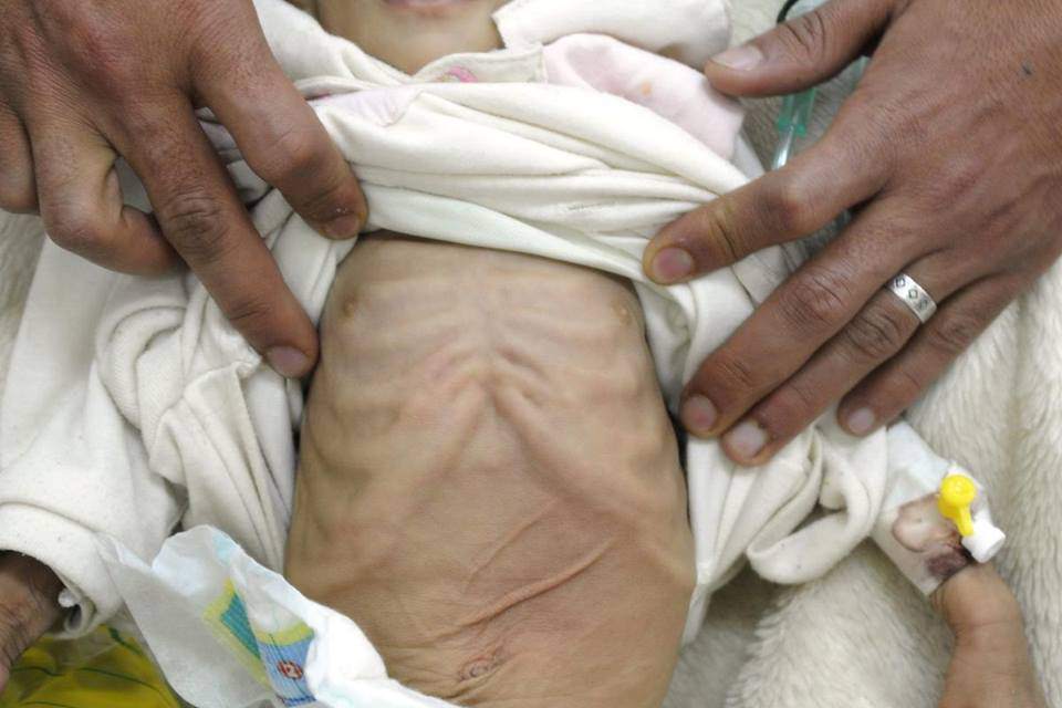 bac si huong dan 4 cach phong ngua va nguyen tac co ban xu tri khi tre bi tieu chay - 7