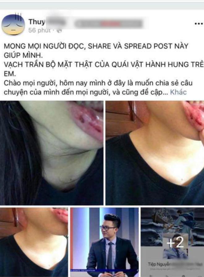 truong amsterdam chinh thuc len tieng vu nu sinh to bi btv minh tiep bao hanh - 1