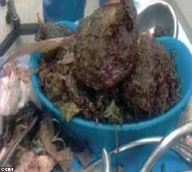 sot ruot khi thay "em be" khong dap, thai phu di kiem tra moi phat hien su that gay soc - 2