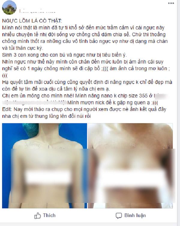 de 3 con, kho so khi nguc gan nhu... tieu bien, me bim sua quyet dinh dung cham "dao keo"! - 1