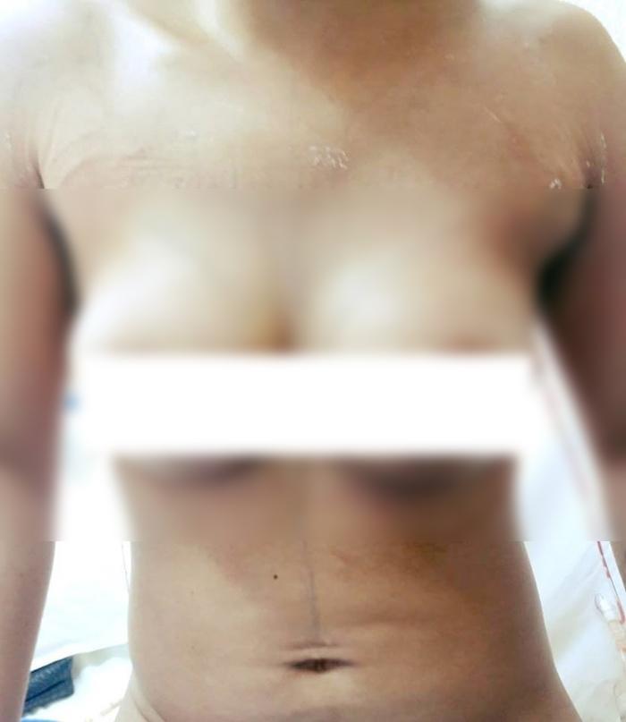 de 3 con, kho so khi nguc gan nhu... tieu bien, me bim sua quyet dinh dung cham "dao keo"! - 2