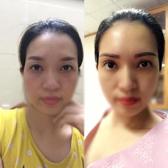 nang chan may cai thien nep nhan va mi sup nhung khong chi danh cho phu nu trung nien! - 10